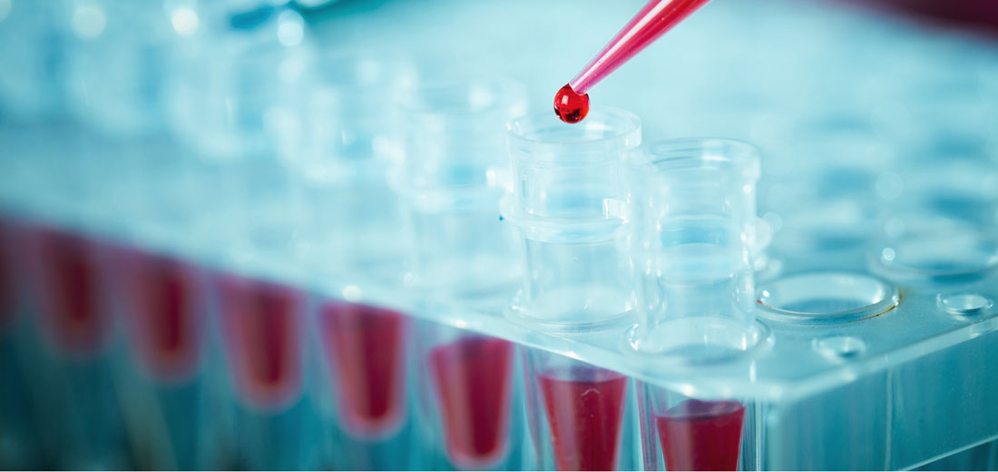 Laboratory analysis